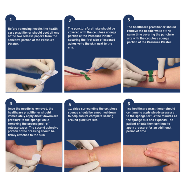 Aidplast Sterile Hemostatic Pressure Plaster 38mm x 38mm (100) - Image 3