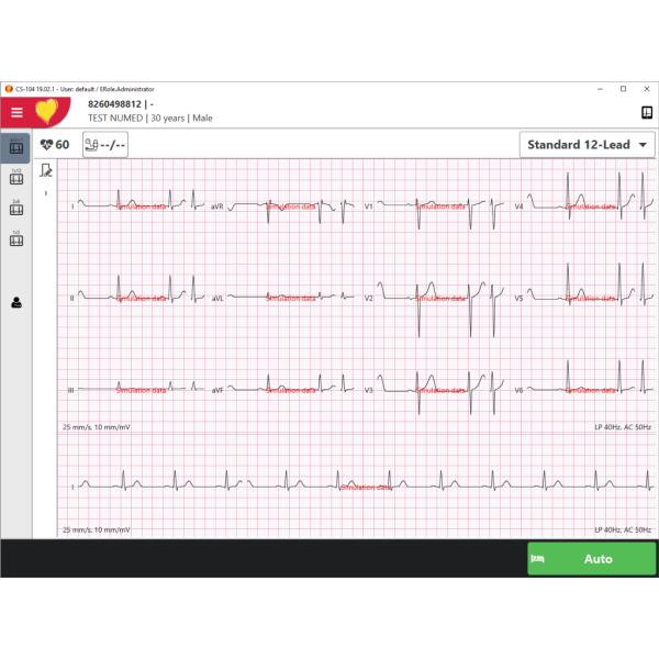 Schiller Cardiovit CS-104 PC Based Resting ECG System - Quarterly Rental - Image 3
