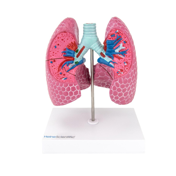 Lung Model with Diseases