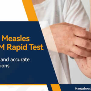 Measles Test