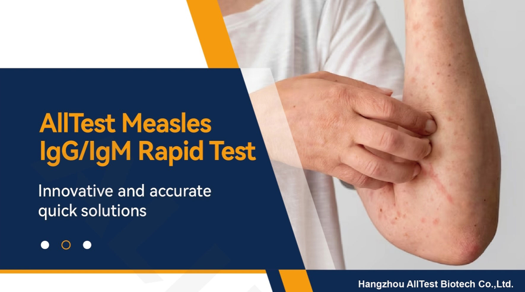Measles Test
