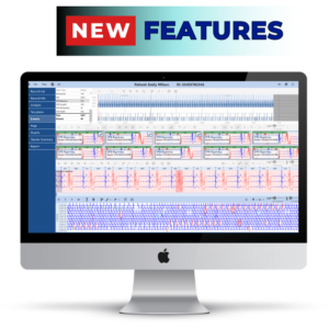 Norav Holter ECG Analysis High End Software