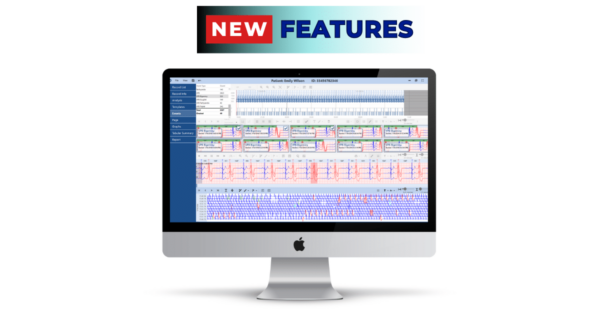 Norav Holter ECG Analysis High End Software