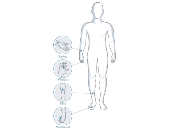 Sunlight MiniOmni Ultrasound Osteoporosis Screening With CM Probe + Software - Image 6
