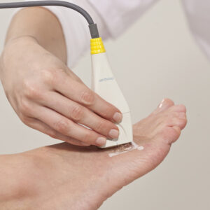 CR-PROBE for Metatarsal for 56800 - Optional Need 56805