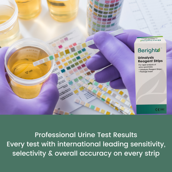 urine test strips