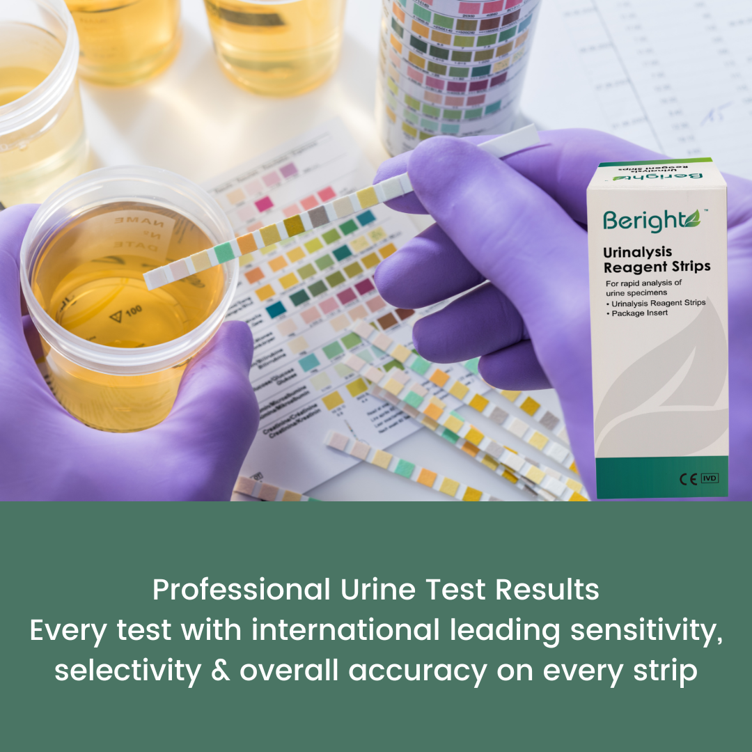 urine test strips