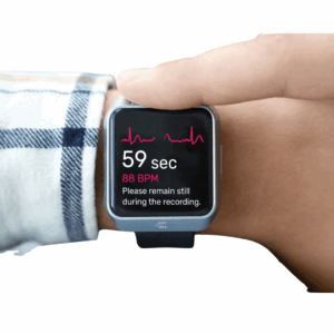 Wearable Cardiac Watch With ECG & AFib Detection. TeltoHeart's Smartwatch