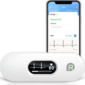 Duoek S Hand-Held Portable ECG Monitor