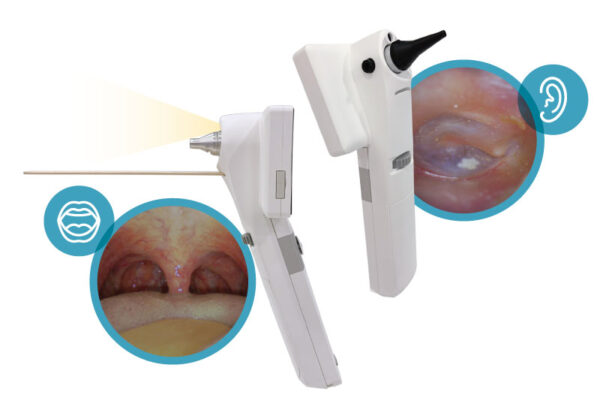 Otoscope Horus Scope EOC 700 - Image 5